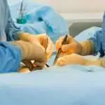 La chirurgie des orteils marteaux