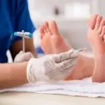 Le pied diabétique : causes, symptômes et traitements