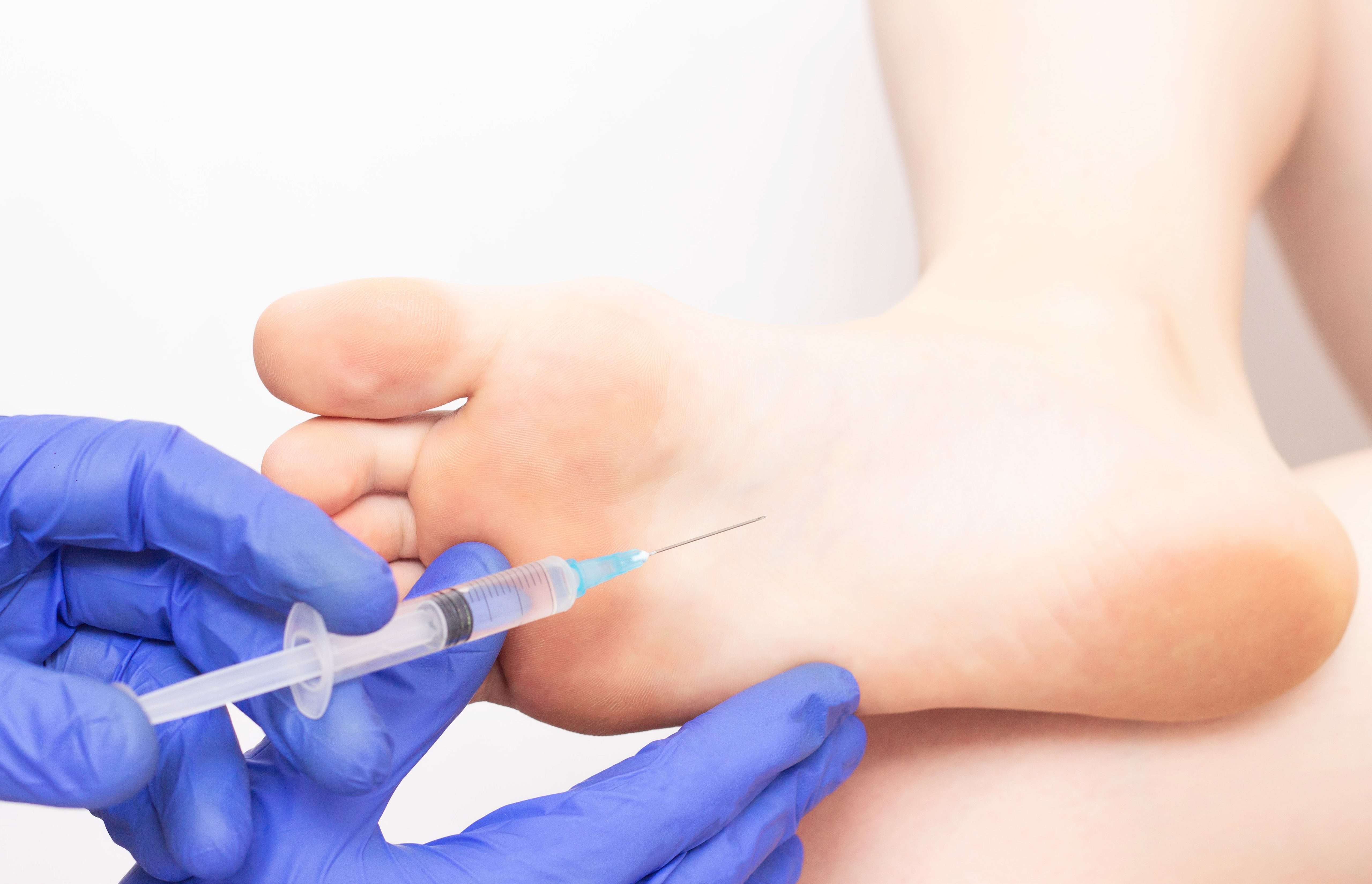 Image de :Cortisone injections