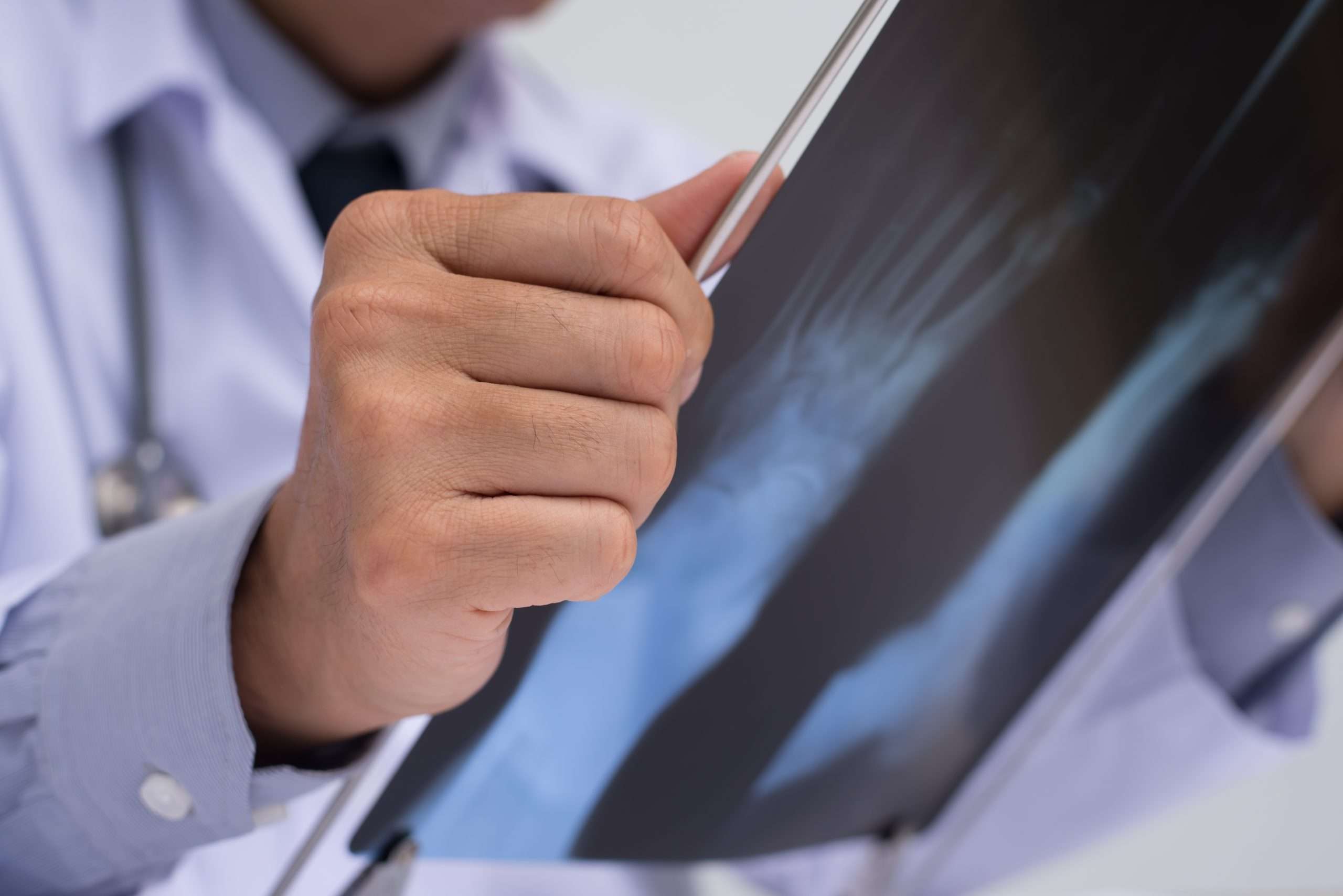 Image de :Marcher avec une fracture du pied