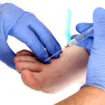 L’injection d’acide hyaluronique pour les articulations du pied