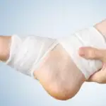 La chirurgie de tissu mou (exérèse) ou de corps étranger