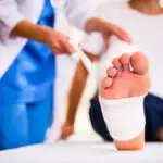 La chirurgie des kystes aux pieds